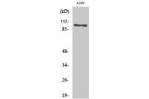 Western Blotting (WB) image for anti-Sodium Potassium ATPase, alpha1 (ATP1A1) (Ser16) antibody (ABIN3176206) (ATP1A1 Antikörper  (Ser16))