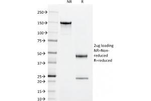 SDS-PAGE Analysis Purified CD55 Mouse Monoclonal Antibody (143-30). (CD55 Antikörper)