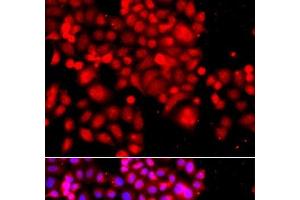 Immunofluorescence analysis of A549 cells using ASCC3 Polyclonal Antibody (ASCC3 Antikörper)