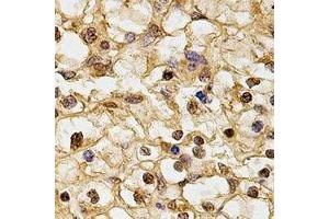 Immunohistochemical analysis of HUS1 staining in human kidney formalin fixed paraffin embedded tissue section.
