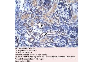 Immunohistochemistry (IHC) image for anti-TAF1 RNA Polymerase II, TATA Box Binding Protein (TBP)-Associated Factor, 250kDa (TAF1) (C-Term) antibody (ABIN2779667)