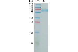 SDS-PAGE (SDS) image for Basigin (Ok Blood Group) (BSG) (AA 140-323) protein (Fc Tag) (ABIN6964132)