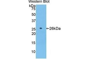 Detection of Recombinant AZU1, Human using Polyclonal Antibody to Azurocidin (AZU) (Azurocidin Antikörper  (AA 23-247))
