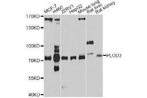 Western blot analysis of extracts of various cell lines, using PLOD3 antibody (ABIN5998540) at 1/1000 dilution. (PLOD3 Antikörper)