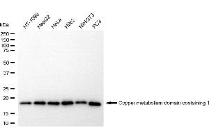 Western blotting analysis using copper metabolism domain containing 1 antibody (ABIN7798154).