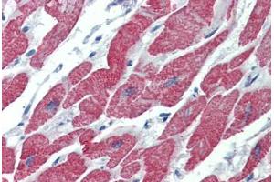 Anti-ALK-1 antibody IHC staining of human heart.