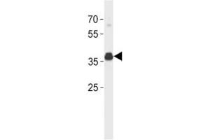 ER antibody (isoform 4) western blot analysis in SK-BR-3 lysate. (Estrogen Receptor alpha Antikörper  (Isoform 4))