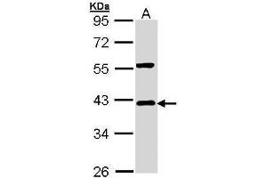 WB Image Sample (30 ug of whole cell lysate) A: Hep G2 , 10% SDS PAGE antibody diluted at 1:1000 (NFKBIA Antikörper  (Center))