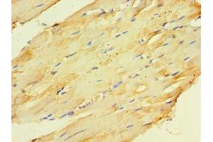 Immunohistochemistry of paraffin-embedded human skeletal muscle tissue using ABIN7148666 at dilution of 1:100