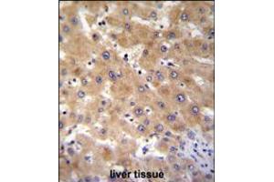 GAGE12B Antibody immunohistochemistry analysis in formalin fixed and paraffin embedded human liver tissue followed by peroxidase conjugation of the secondary antibody and DAB staining. (G Antigen 12B Antikörper  (N-Term))