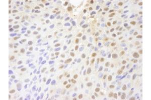 Immunohistochemistry (IHC) image for anti-Poly (ADP-Ribose) Polymerase Family, Member 10 (PARP10) (AA 300-350) antibody (ABIN7448715) (PARP10 Antikörper  (AA 300-350))