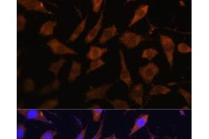 Immunofluorescence (IF) image for anti-serpin Peptidase Inhibitor, Clade B (Ovalbumin), Member 9 (SERPINB9) antibody (ABIN7262204)