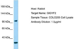 Host: Rabbit Target Name: GIGYF2 Sample Type: COLO205 Whole Cell lysates Antibody Dilution: 1.