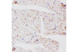Immunohistochemistry (IHC) image for anti-Solute Carrier Family 2 (Facilitated Glucose Transporter), Member 4 (SLC2A4) (AA 333-509) antibody (ABIN3043929)
