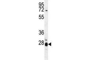 IL17B antibody  (AA 39-66)
