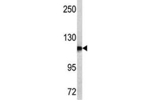 Western blot analysis of NPEPPS antibody and MCF-7 lysate. (NPEPPS Antikörper  (AA 709-737))
