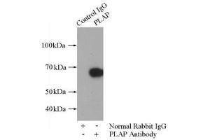IP analysis of HepG2 cell lysates (1800 μg), using PLAP antibody (1/800 dilution). (PLAP Antikörper)