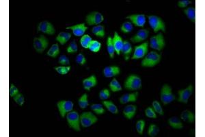 Immunofluorescence staining of Hela cells with ABIN7142862 at 1:133, counter-stained with DAPI. (INPP5E Antikörper  (AA 1-133))