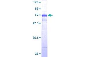 Cyclin D1 Protein (CCND1) (AA 1-295) (GST tag)