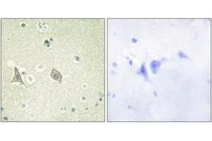 Immunohistochemistry analysis of paraffin-embedded human brain, using M-CSF Receptor (Phospho-Tyr723) Antibody. (CSF1R Antikörper  (pTyr723))