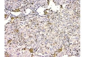 IHC analysis of GPX1 using anti GPX1 antibody (ABIN6719520). (Glutathione Peroxidase 1 Antikörper  (Middle Region))