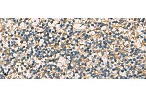 Immunohistochemistry of paraffin-embedded Human tonsil tissue using STX6 Polyclonal Antibody at dilution of 1:60(x200) (Syntaxin 6 Antikörper)
