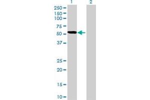 Western Blot analysis of PDLIM7 expression in transfected 293T cell line by PDLIM7 MaxPab polyclonal antibody. (PDLIM7 Antikörper  (AA 1-457))