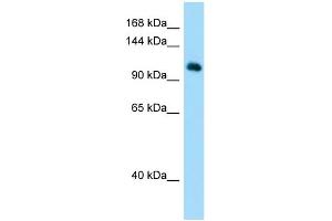 Host: Rabbit Target Name: MYSM1 Sample Type: Hela Whole Cell lysates Antibody Dilution: 1. (MYSM1 Antikörper  (N-Term))