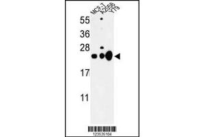 Western blot analysis of CBX1 Antibody in MCF-7, A2058, Y79 cell line lysates (35ug/lane) (CBX1 Antikörper  (C-Term))