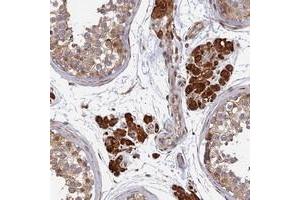 Immunohistochemical staining of human testis with OR14J1 polyclonal antibody  shows strong cytoplasmic positivity in Leydig cells at 1:20-1:50 dilution. (OR14J1 Antikörper)