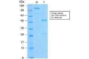 SDS-PAGE Analysis of Purified BCL2 Rabbit Recombinant Monoclonal Antibody ABIN6383843. (Rekombinanter Bcl-2 Antikörper)