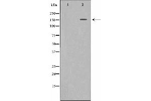 Western blot analysis of c-Met expression in HepG2 whole cell lysates,The lane on the left is treated with the antigen-specific peptide. (c-MET Antikörper  (Internal Region))