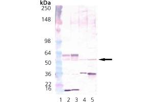 Western Blot Analysis of CaMKII: Lane 1: MWM, Lane 2: Brain (mouse), (tissue extract)  Lane 3:Brain (rat), (tissue extract)  Lane 4: HeLa, (cell lysate)  Lane 5: Hs-67 cell lysate. (CAMK2A Antikörper  (N-Term))