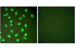 Immunofluorescence analysis of HepG2 cells, using MCM2 Antibody. (MCM2 Antikörper  (AA 1-50))