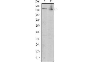 Western blot analysis using KIT mouse mAb against Jurkat (1) and Hela (2) cell lysate.