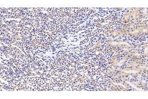 Immunohistochemistry (IHC) image for anti-Hepatocyte Growth Factor (Hepapoietin A, Scatter Factor) (HGF) (AA 482-710) antibody (ABIN7430567)