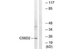 Western Blotting (WB) image for anti-Cytochrome B-561 Domain Containing 2 (CYB561D2) (AA 55-104) antibody (ABIN2889870) (CYB561D2 Antikörper  (AA 55-104))