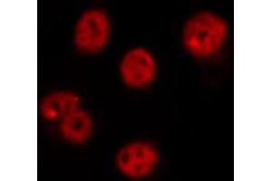 ABIN6269215 staining RAW264. (CDC25C Antikörper  (Internal Region))