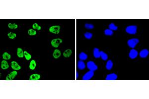 HeLa cells were stained with MSK1 (Ser376) (11A1) Monoclonal Antibody  at [1:200] incubated overnight at 4C, followed by secondary antibody incubation, DAPI staining of the nuclei and detection. (MSK1 Antikörper  (pSer376))