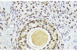 Immunohistochemistry of paraffin-embedded Rat ovary using Phospho-Histone H3(T11) Polyclonal Antibody at dilution of 1:100 (40x lens).