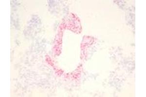 Immunohistochemical staining (Frozen Sections) of RSV-infected lung tissue (Guinea pig) (RSV Antikörper)