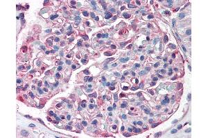 Immunohistochemistry (IHC) image for anti-Solute Carrier Family 39 (Zinc Transporter), Member 14 (SLC39A14) (Internal Region) antibody (ABIN960808)