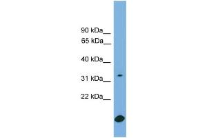 WB Suggested Anti-RAB9A Antibody Titration:  0.
