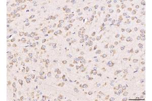 IHC analysis of RPL29 using anti-RPL29 antibody (ABIN7600993). (RPL29 Antikörper  (AA 27-153))