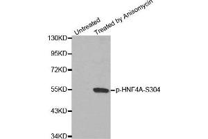 Western blot analysis of extracts from Hela cells, using Phospho-HNF4A-S304 antibody. (HNF4A Antikörper  (pSer304))