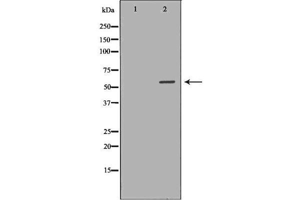 AIRE Antikörper  (Internal Region)