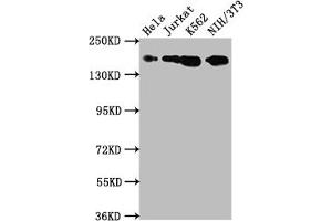 Western Blot Positive WB detected in: Hela whole cell lysate, Jurkat whole cell lysate, K562 whole cell lysate, NIH/3T3 whole cell lysate All lanes: TOP2A antibody at 1:1500 Secondary Goat polyclonal to rabbit IgG at 1/50000 dilution Predicted band size: 175, 178, 179, 183 kDa Observed band size: 175 kDa