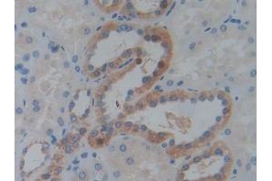 IHC-P analysis of Human Kidney Tissue, with DAB staining. (IGF2BP3 Antikörper  (AA 2-343))
