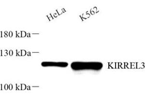 Western blot analysis of KIRREL3 (ABIN7074434) at dilution of 1: 2000 (KIRREL3 Antikörper)