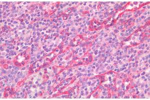 (ABIN5539582) (5 μg/mL) staining of paraffin embedded Human Spleen. (STAT5A Antikörper  (AA 681-692))
